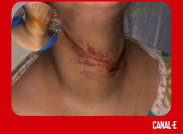 CABLE SUELTO CASI DEGOLLA A UNA MUJER