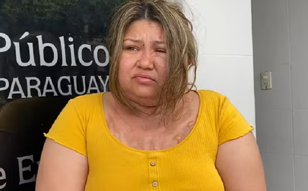 Le derramaron agua caliente por pedir que le devuelvan su dinero - Noticiero Paraguay