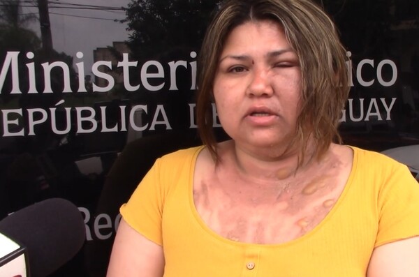 Por reclamar presunta deuda, le derramaron agua caliente - trece