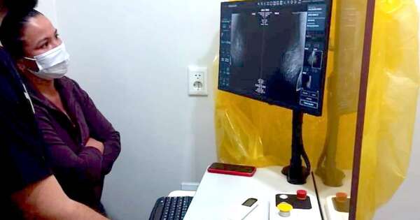 La Nación / Primera prueba exitosa marca inicio de la telemamografía