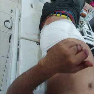 Intentaron asaltarlo y luego lo apuñalaron con un cuchillo, ocurrió en Arroyo Porã