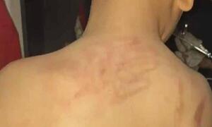 Dos niños son víctimas de brutales golpizas en Ciudad del Este – Prensa 5