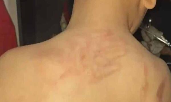 Dos niños son víctimas de brutales golpizas en Ciudad del Este – Prensa 5