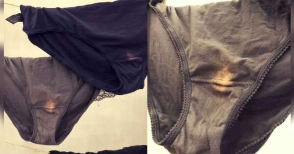 Diario HOY | Desmitificando el pH vaginal: manchas en la ropa interior y lo que significan