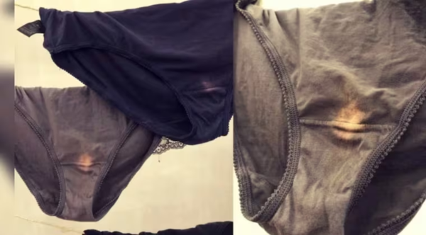 Desmitificando el pH vaginal: manchas en la ropa interior y lo que significan