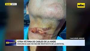 Otra víctima de cables de la ANDE denuncia que no recibe respuesta de la estatal - ABC Noticias - ABC Color