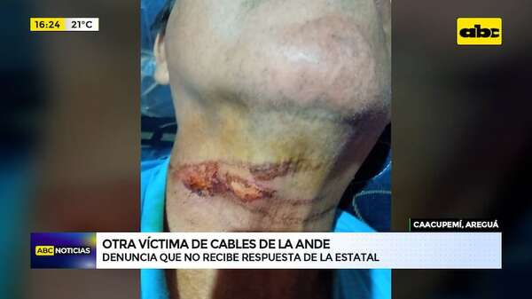Otra víctima de cables de la ANDE denuncia que no recibe respuesta de la estatal - ABC Noticias - ABC Color