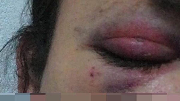Agreden brutalmente a mujer trans en la calle