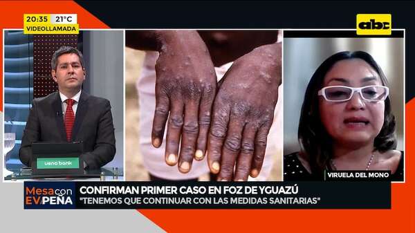 Primer caso de viruela del mono en Foz de Yguazú: “Brasil lidera, con más de 1000 casos” - Mesa de Periodistas - ABC Color