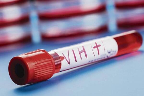 Brasil: Al menos 6 personas dan positivo en VIH por trasplantes de órganos infectados - ADN Digital