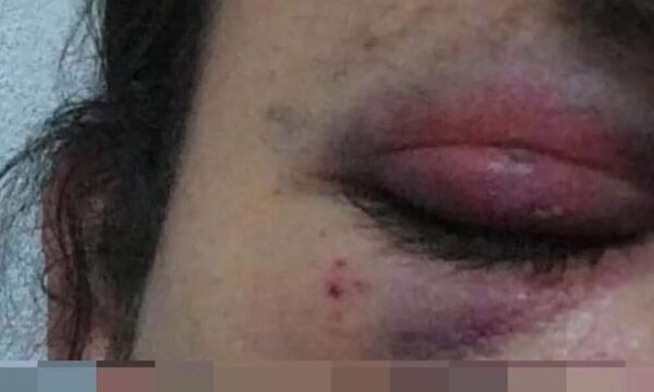 Trans fue reventado a golpes con una manopla en plena calle