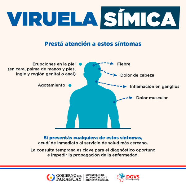 Mpox: Salud confirma que Paraguay se mantiene sin casos, pero con vigilancia activa - .::Agencia IP::.