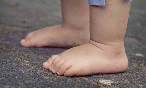 Tragedia en Caacupé: bebé muere tras caer de la camioneta de su papá – Prensa 5