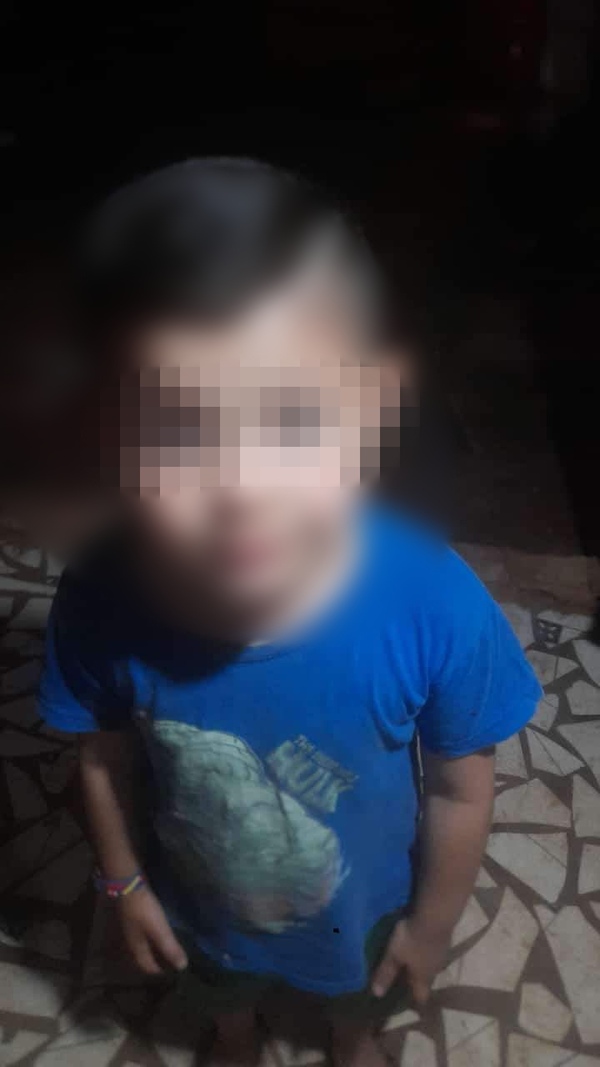 Niño sufre la amputación de una pierna tras un accidente de tránsito