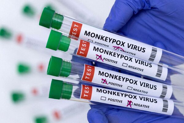 MPOX: SALUD CONFIRMA QUE PARAGUAY SE MANTIENE SIN CASOS, PERO CON VIGILANCIA ACTIVA - Itapúa Noticias