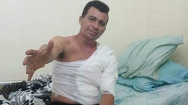Rayo cayó por él cuando iba en moto y logró sobrevivir