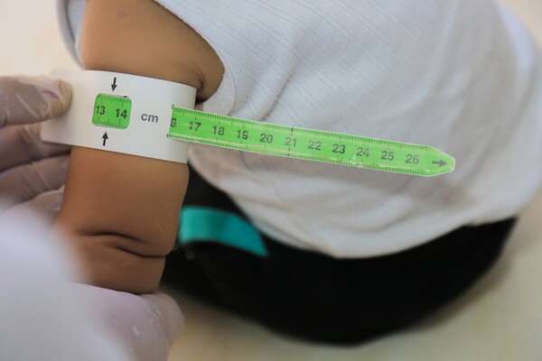 Día Mundial de la Alimentación: esta es la situación de los niños en las escuelas - Nacionales - ABC Color