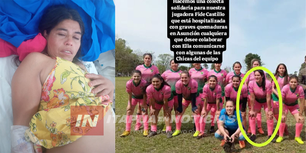 MIENTRAS DESPLUMABAN GALLINAS UNA NIÑA Y DOS MUJERES SUFRIERON GRAVES QUEMADURAS - Itapúa Noticias