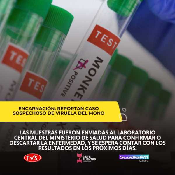 REPORTAN CASO SOSPECHOSO DE VIRUELA DEL MONO EN ENCARNACIÓN - TVS