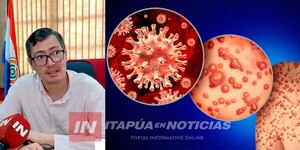 ENCARNACIÓN: INVESTIGAN DOS CASOS SOSPECHOSOS DE VIRUELA DEL MONO - Itapúa Noticias