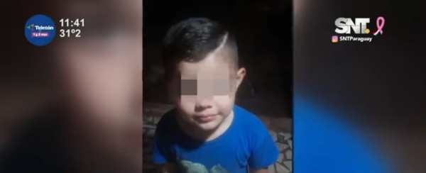 Niño de 5 años es amputado tras grave accidente de tránsito en Concepción - SNT