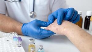 ¿Qué es el temido mpox y cómo se contagia?