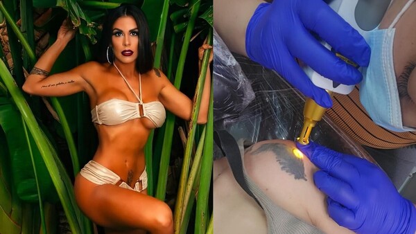 Modelo se está borrando con láser sus tatuajes: “Sufrí el prejuicio”