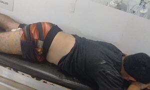Hieren a hombre en CDE