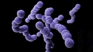 Salud confirma muerte de una estudiante de Capiatá por bacteria