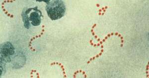 Diario HOY | Mitos y realidades sobre la bacteria estreptococo en niños y adolescentes