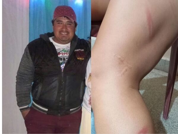 ¡Infeliz, desgraciado y celoso le metió escobazos a su doña porque estaba chateando!