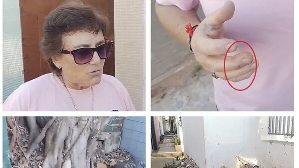Fue de visita al cementerio y un alacrán le picó en la mano