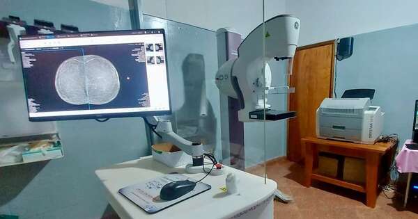 Diario HOY | Implementan la telemamografía en Itapúa: ¿en qué consiste el método?