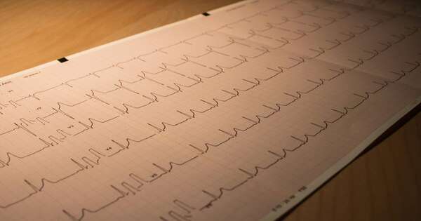 La Nación / Identifican las señales de infarto menos reconocidas por la población