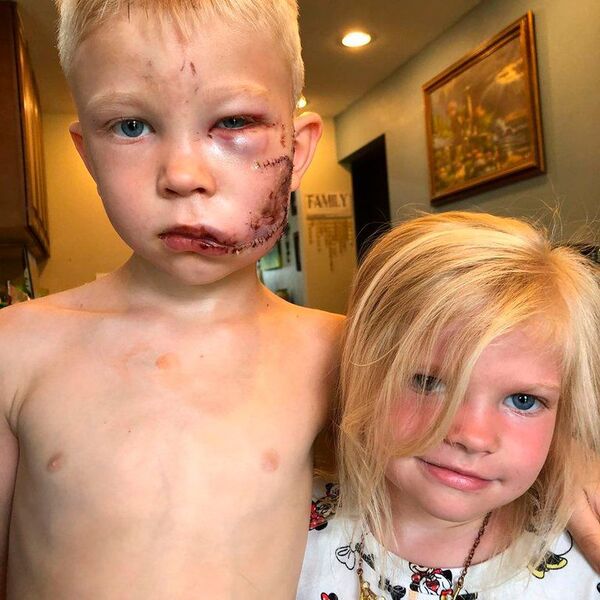 “Si alguien debía morir, tenía que ser yo”, dice niño de 6 años tras salvar a su hermanita de un perro