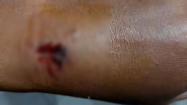 Joven violento maltrató a su mamá y mordió a policía