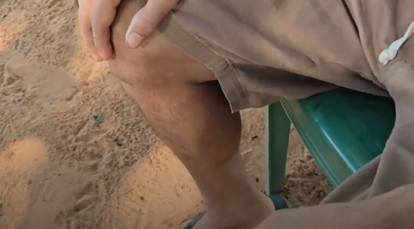 Hombre fue abusado sexualmente y golpeado por otros hombres - Noticiero Paraguay