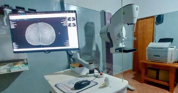 Diario HOY | Telemamografía se implementará en más hospitales de Itapúa