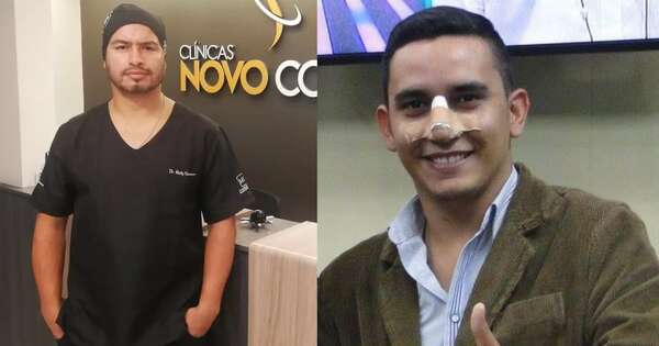 Diario HOY | Cirujano plástico descarta rinoplastia en Mariano López