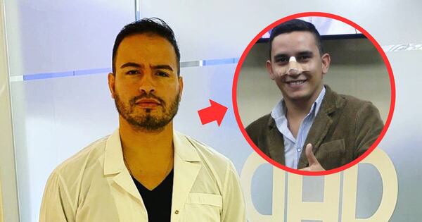 La Nación / Rinolux y bótox: cirujano opina de los supuestos cambios de Mariano López