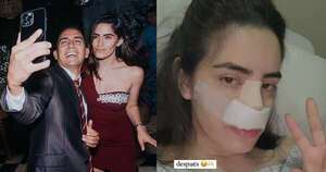 Diario HOY | ¿2 por 1?: Novia de Mariano López presume rinoplastia