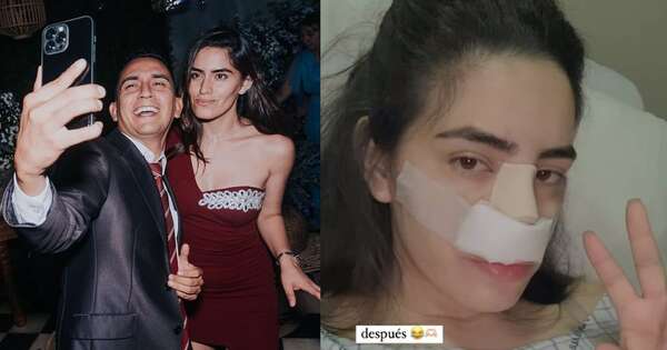 Diario HOY | ¿2 por 1?: Novia de Mariano López presume rinoplastia