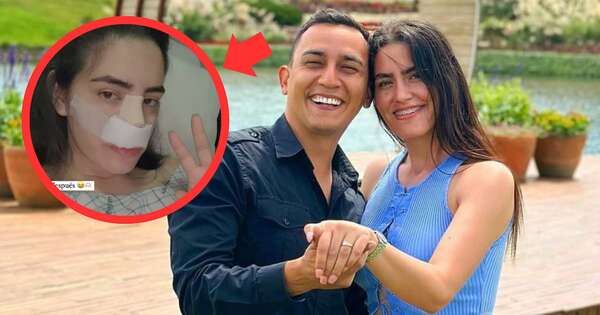 La Nación / Prometida de Mariano López confirma rinoplastia: “Hace un mes”