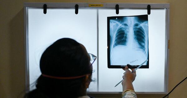 La Nación / Estudio sobre la tuberculosis ganó el Premio Nacional de Ciencias 2024