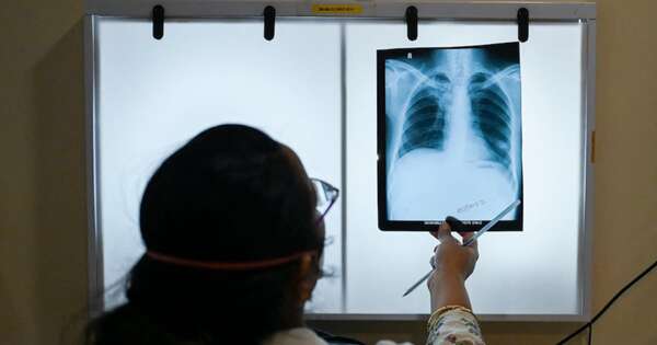La Nación / Estudio sobre la tuberculosis ganó premio de ciencias