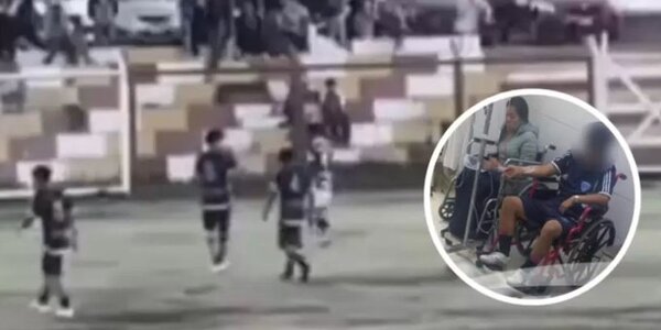 (VIDEO) Imágenes sensibles: ¡Rayo fulmina a pelotero y hiere a varios otros al caer en pleno partido!