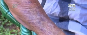 Septuagenaria sufre brutal agresión por parte de un adicto en Barrero Grande - SNT