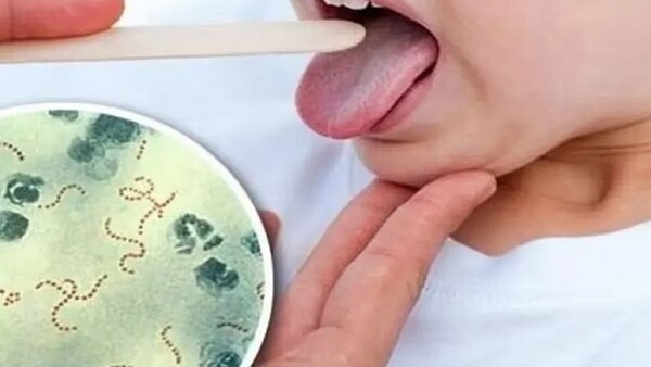 CDE: Suspenden clases en escuela tras detectar caso de Streptococcus