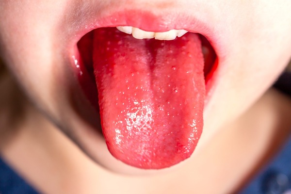Suspenden clases tras confirmarse caso de Streptococcus en Ciudad del Este - Unicanal