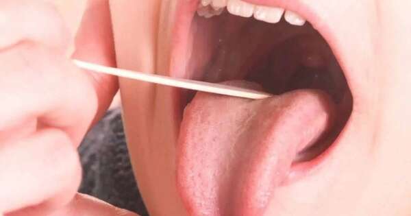 La Nación / Salud emite recomendaciones para evitar contagios de infecciones por Streptococcus pyogenes